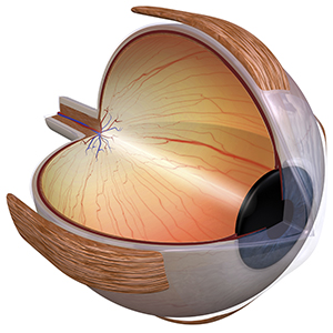 Keratoconus Specialist Des Plaines IL