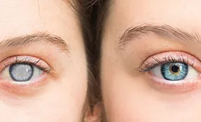 Glaucoma Specialist Des Plaines IL