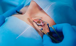 LASIK Eye Surgery Des Plaines IL